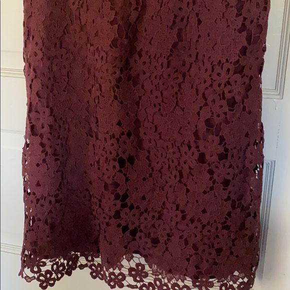 Abercrombie dress - Picture 2 of 5